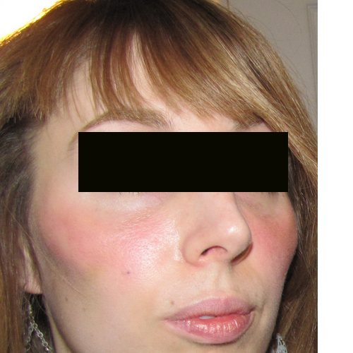 résultat de 3/4 au 7ème jour