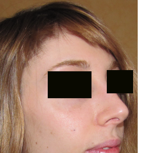 même patiente de 3/4