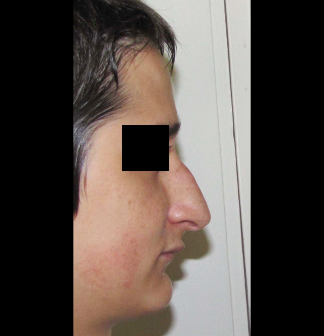 même patient de profil